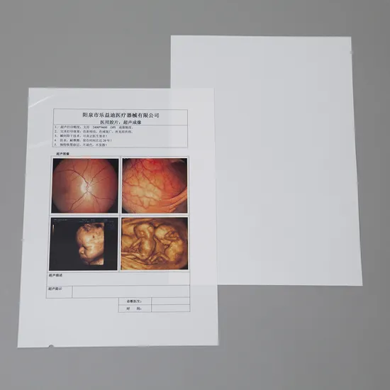 Ultrasound Digital Printing Blue and White Inkjet Film 